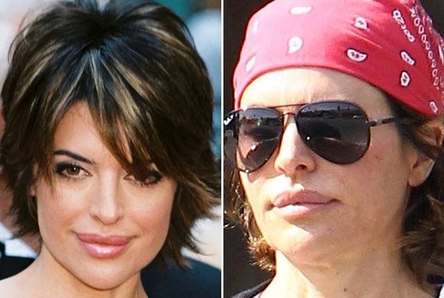 Najgorsze przypadki operacji plastycznych