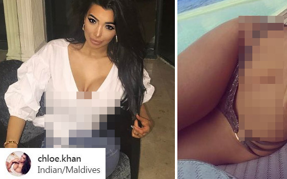 Chloe Khan operacyjnie zmniejszyła talię, na zdjęciu widać krew! (ZDJĘCIA)