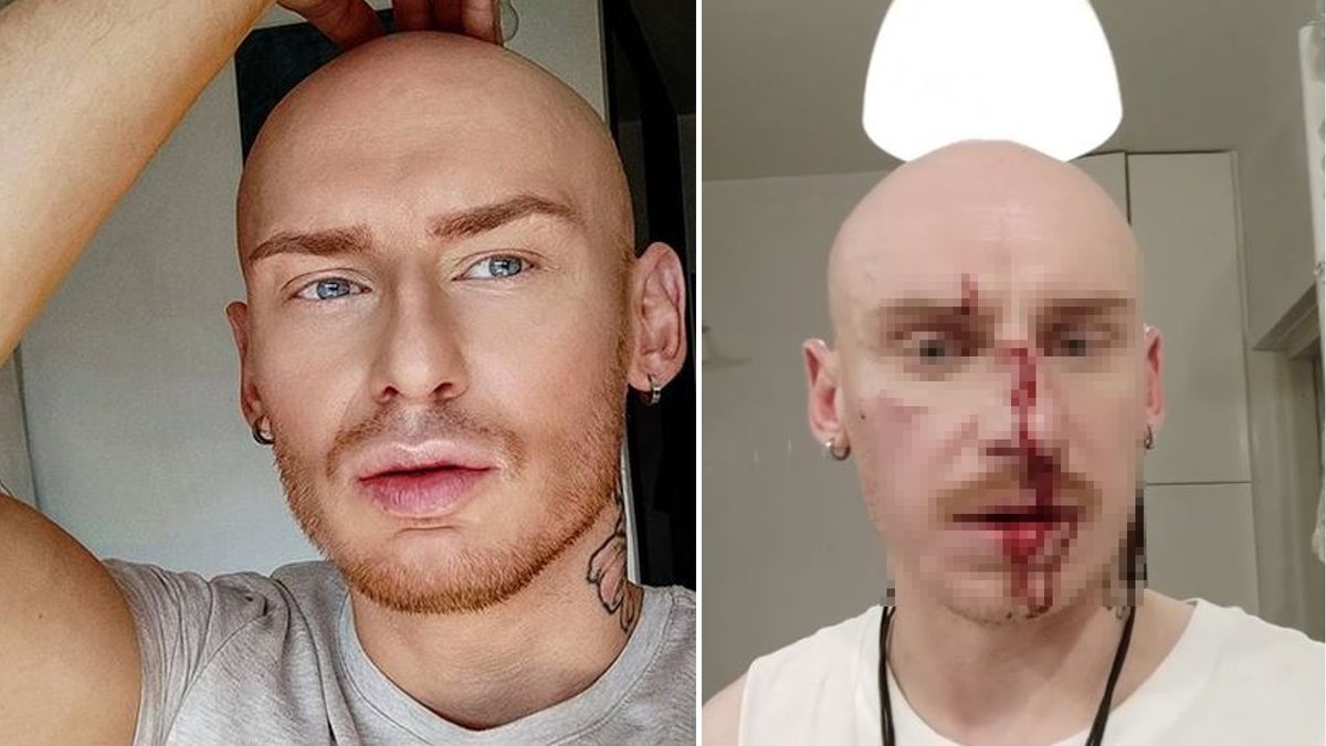 Jacek Szawioła pobity