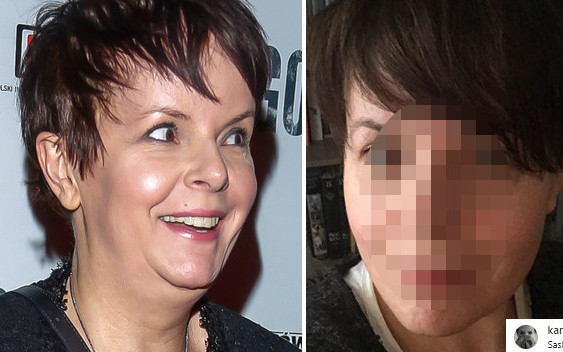 Korwin-Piotrowska pokazała się BEZ MAKIJAŻU: To jest botoks