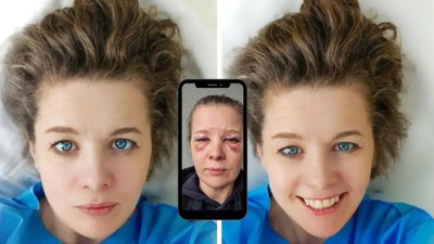 Co się stało Czesi z Klanu? Pokazała posiniaczoną twarz!