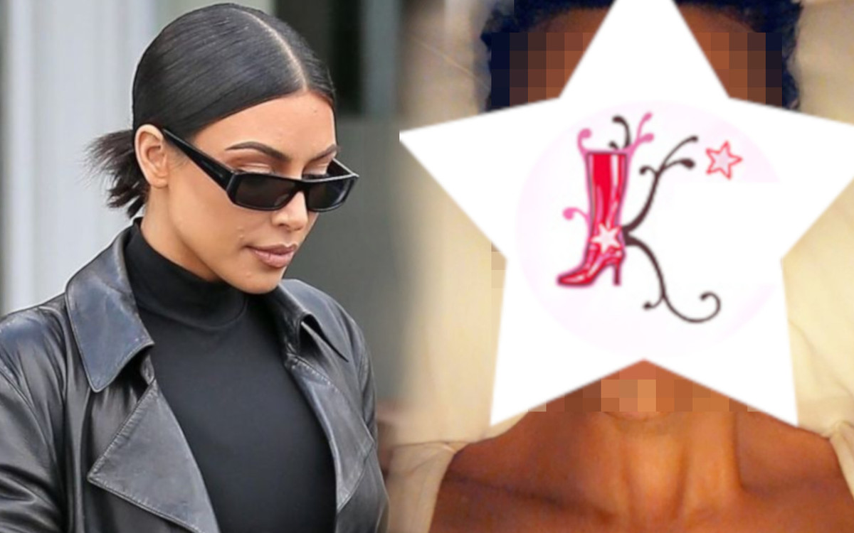 Kim Kardashian pokazała PRZERAŻAJĄCE zdjęcia z łuszczycą