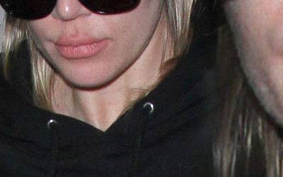 Odstawiła nabiał i z ustami zrobiło się jej TO (FOTO)