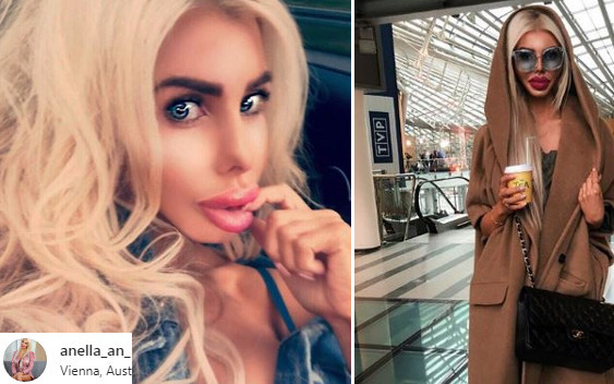 Anella na święta sprawi sobie kolejną operację plastyczną. Ciekawi jaką?