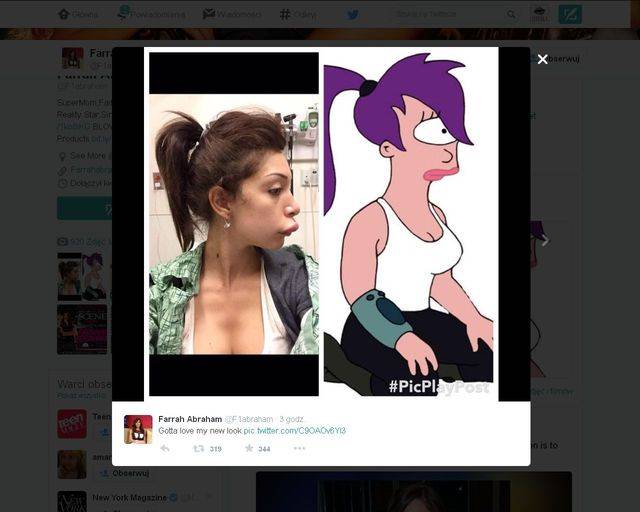 Farrah Abraham – ofiara nieudanego zabiegu powiększania ust