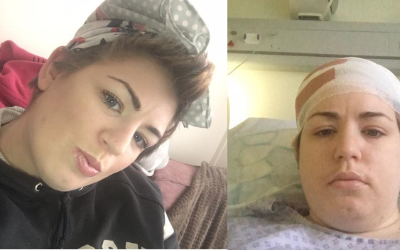 Chciała spróbować modnej koloryzacji…