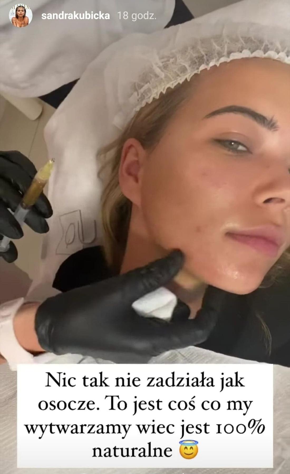 Sandra Kubicka na zabiegu