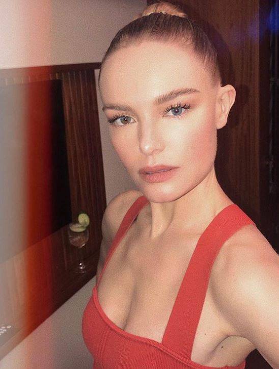 Dwukolorowe tęczówki, czyli heterochromia u gwiazd!