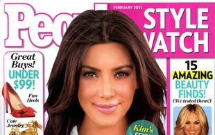 Botoks – sekret gładkiej cery Kim Kardashian?