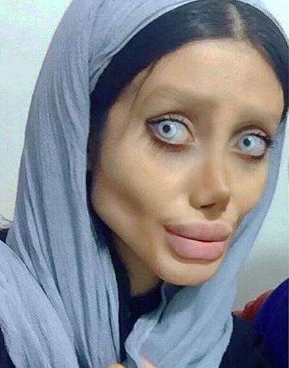 Jej marzeniem było być jak Angelina Jolie, a teraz STRASZY swoim wyglądem