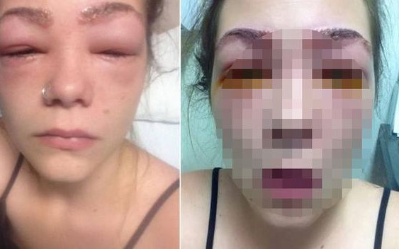 Po użyciu bardzo popularnego kosmetyku stało jej się TO