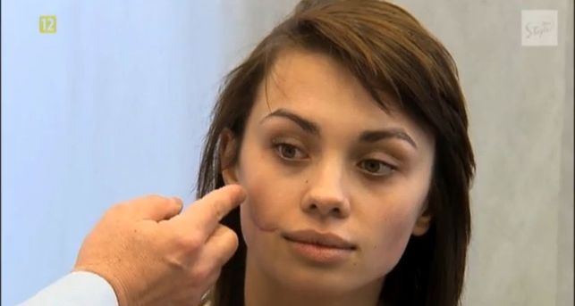 sekrety-chirurgii-R1