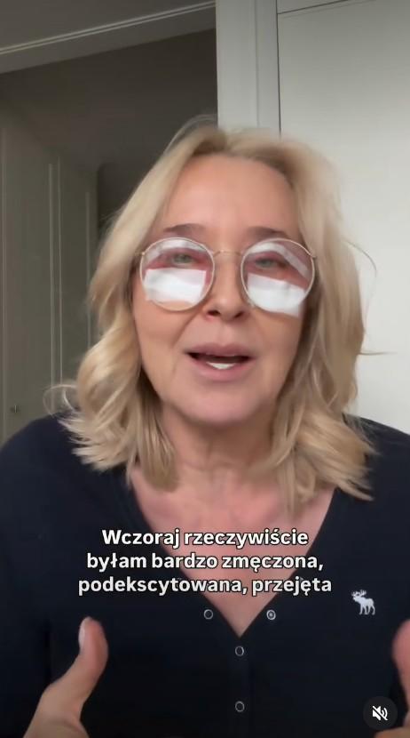 Agata Młynarska przeszła blefaroplastykę, fot. Instagran