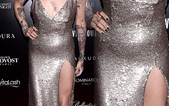 Syndrom Lewandowskiej na salonach (ZDJĘCIA)