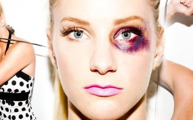 Gwiazda Glee szokuje podbitym okiem (FOTO)