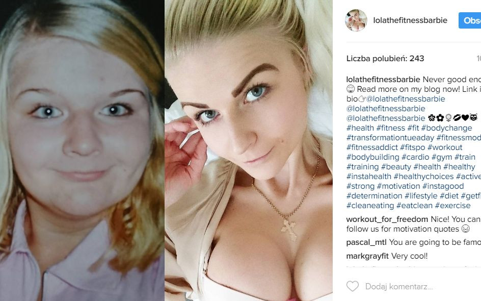 Gdy była tęga, szydzili z niej nazywając Barbie – prawie umarła na anoreksję