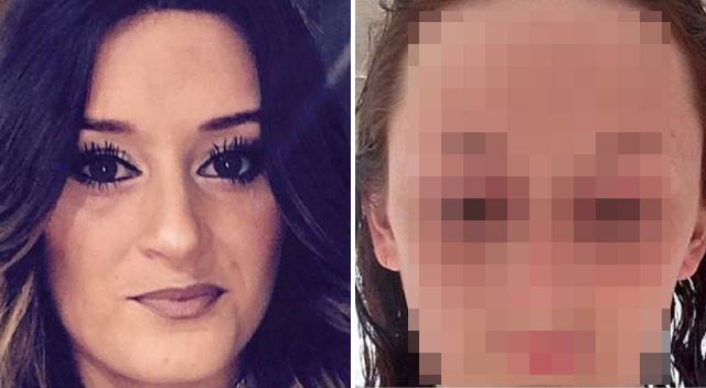 Ta operacja zmieniła jej życie. Wcześniej musiała ukrywać TO pod grzywką