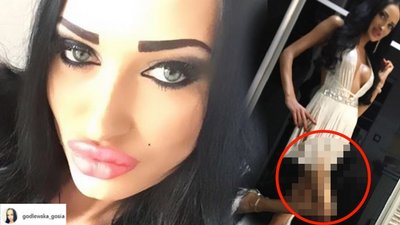 CO się stało z NOGĄ Godlewskiej?! Internauci myślą, że to PROTEZA