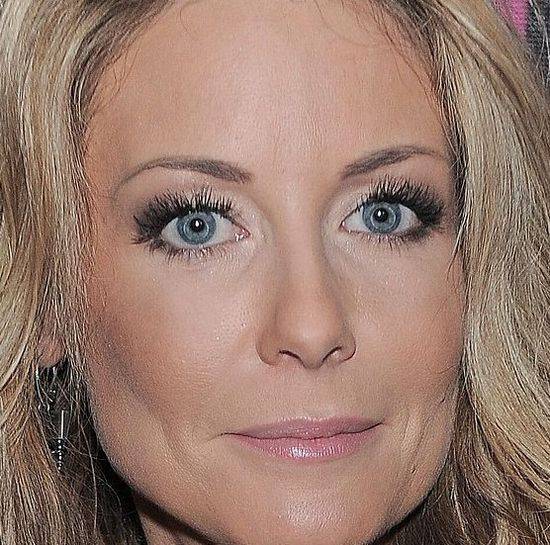 10 zaskakujących zbliżeń na twarz Małgorzaty Rozenek