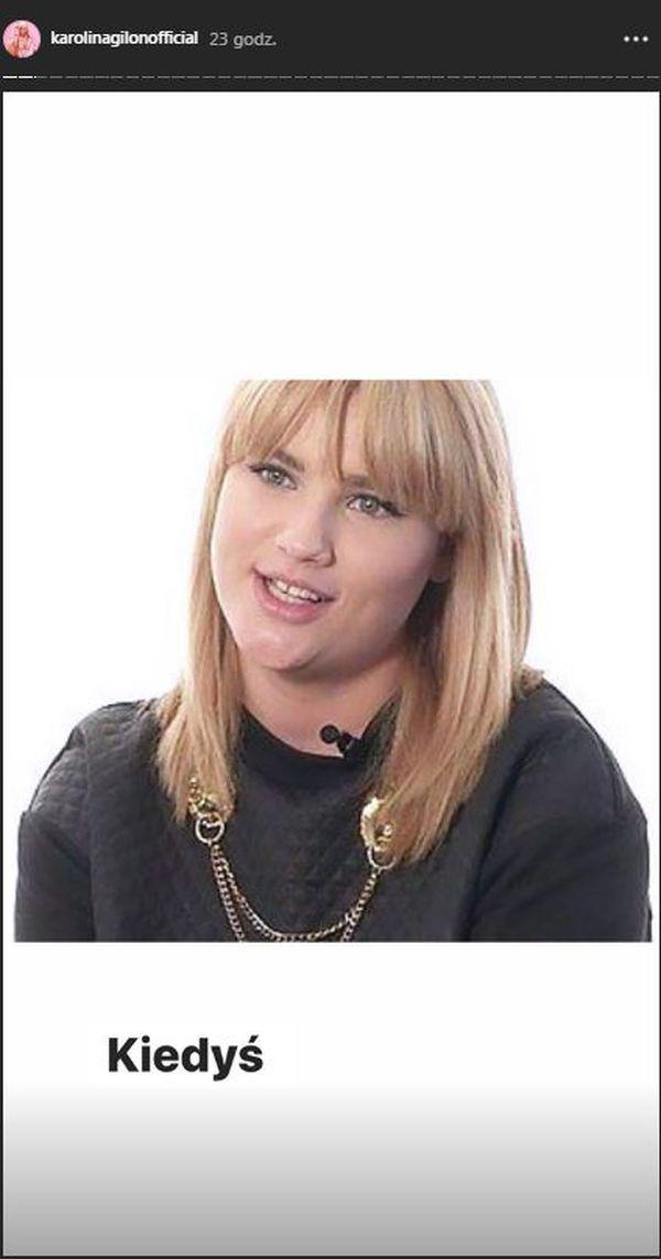 Karolina Gilon na starych zdjęciach, zanim schudła 14 kg