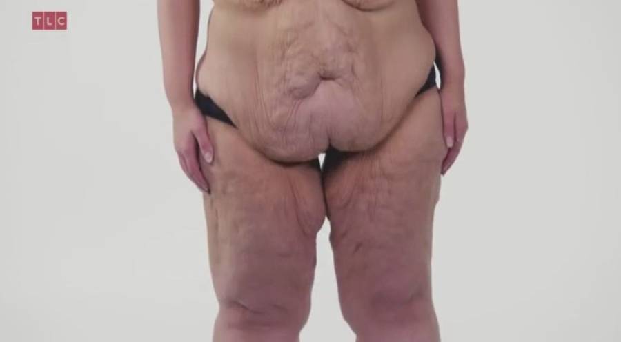 Choć schudła ponad 100 kg, wciąż nie może na siebie patrzeć!