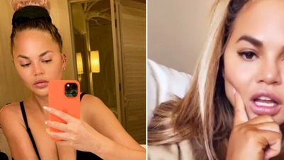 Chrissy Teigen przyznała się, że usunęła z twarzy “poduszki Bichata”