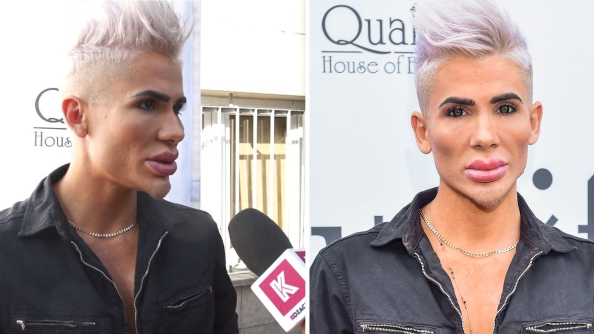 Polski "Żywy Ken" o swoich zabiegach