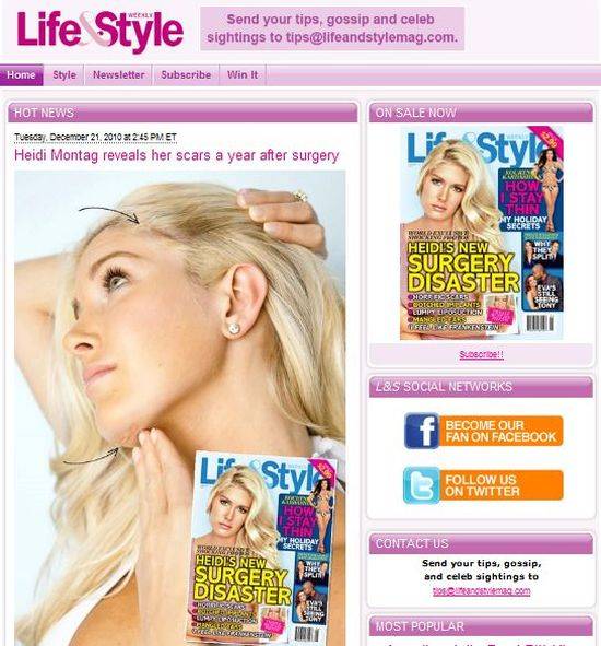 Heidi Montag zrobiła sobie 10 operacji plastycznych w ciągu jednego dnia