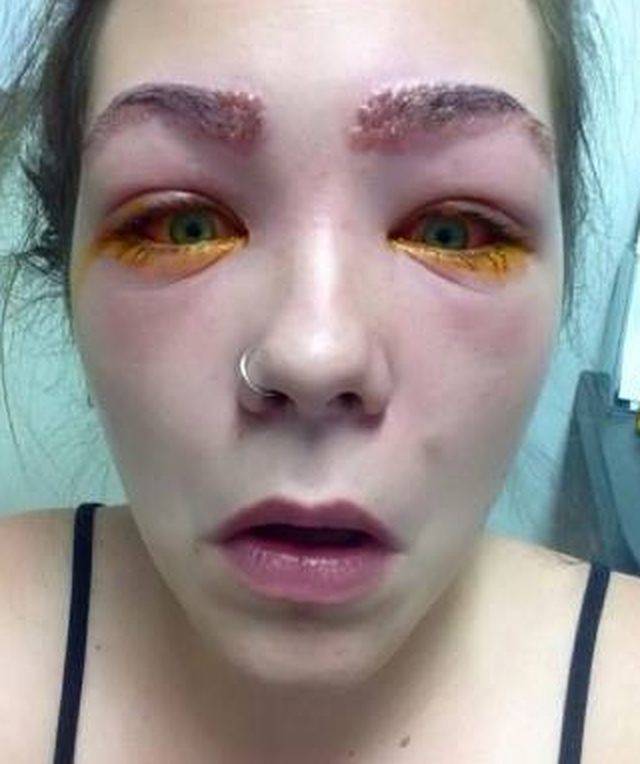 Po użyciu bardzo popularnego kosmetyku stało jej się TO