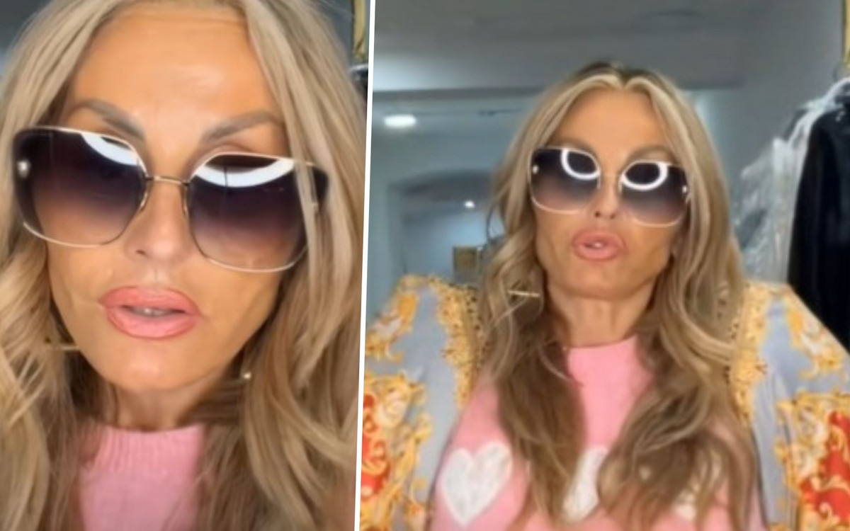 Kaźmierska zrobiła operację plastyczną i teraz ostrzega. Nie tak to miało wyglądać