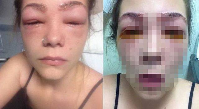 Po użyciu bardzo popularnego kosmetyku stało jej się TO