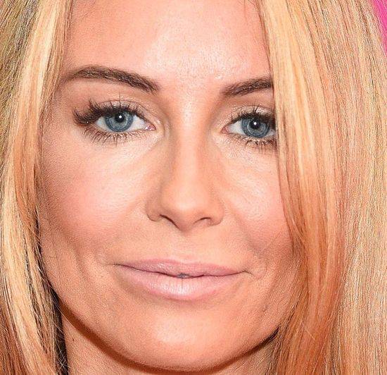 10 zaskakujących zbliżeń na twarz Małgorzaty Rozenek