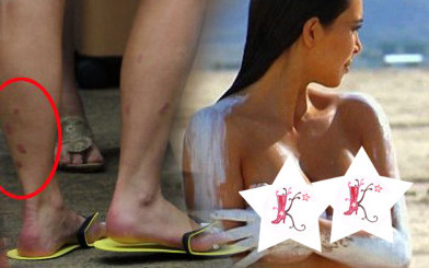 Kim Kardashian: Mam łuszczycę. I znów się rozbiera.