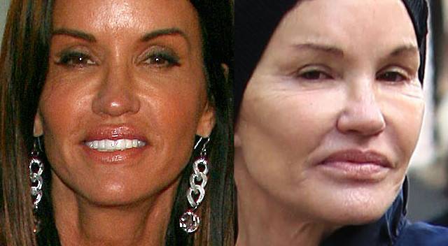 Gwiazdy, które trudno rozpoznać bo NAPOMPOWAŁY usta