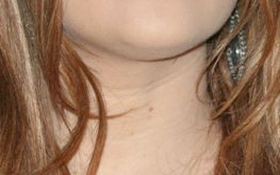 To niesamowite, jak zmieniała się twarz Khloe Kardashian