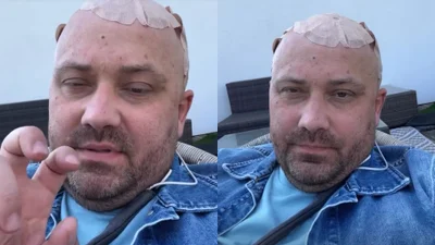 Adrian Szymaniak mówi o dramatycznych skutkach leczenia. Nie ma dobrych wieści