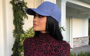 Internet w szoku. Kylie właśnie się zdemaskowała z kolejną operacją plastyczną!