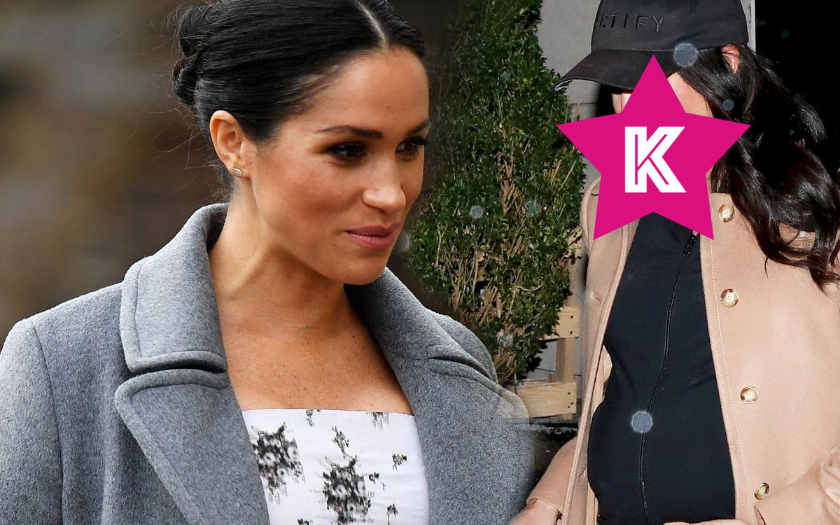 Meghan Markle POWIĘKSZYŁA usta. Za bardzo napompowane?