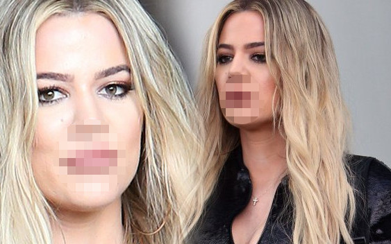 Usta Khloe Kardashian coraz bardziej przypominają… kaczy dziób (FOTO)
