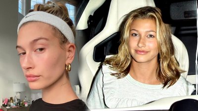 Hailey Bieber napisała o swoich OPERACJACH PLASTYCZNYCH!