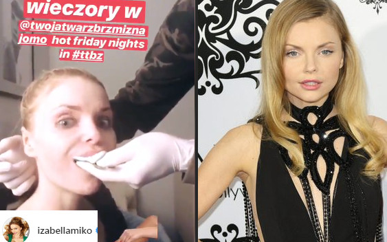 Iza Miko chwali się OBRZYDLIWYM wyciskiem zębów