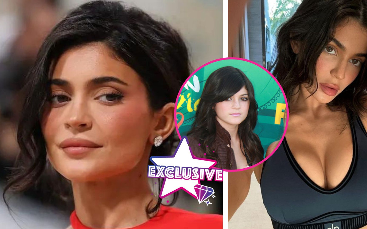 Co poprawiała sobie Kylie Jenner? Specjalista medycyny estetycznej wylicza….