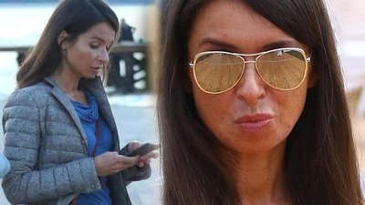 Marta Kaczyńska ostrzega przed SOLARIUM