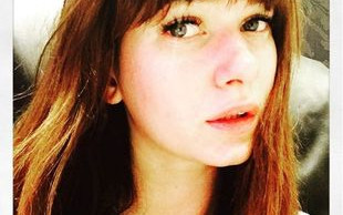 Karolina Malinowska zrobiła sobie zabieg po ciąży (Insta)