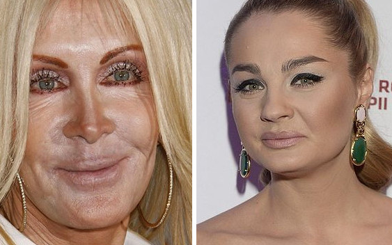 Makijażowe wpadki gwiazd