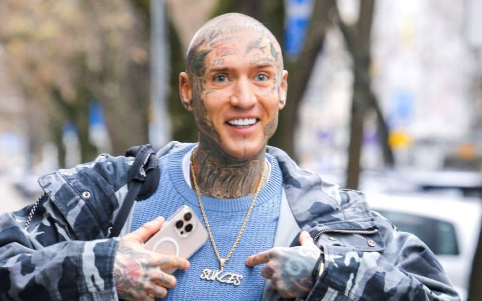 Stifler pokazał doczepione włosy. Fani zszokowani metamorfozą