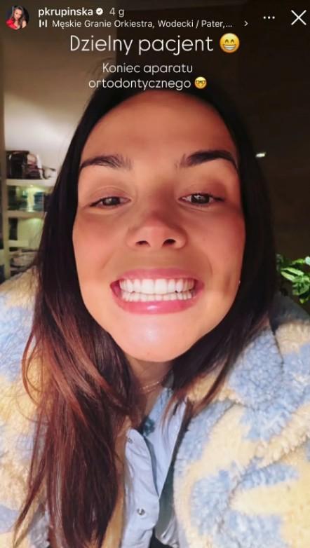 Paulina Krupińska pochwaliła się nowym uśmiechem, fot. Instagram