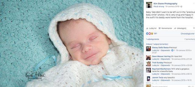 Uśmiech na twarzy tego dziecka kryje za sobą wielką tragedię (FOTO)