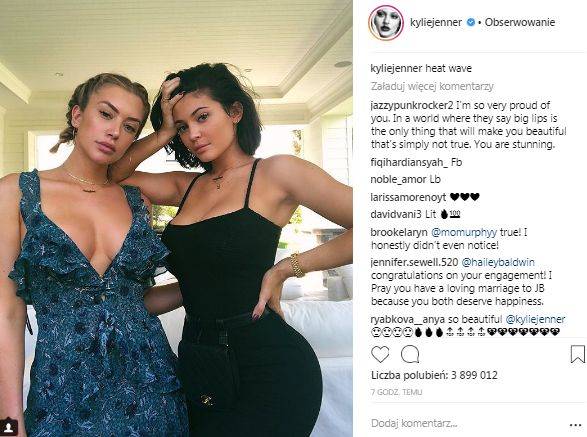 NEWS SEZONU! Kylie Jenner USUNĘŁA wypełniacze z UST