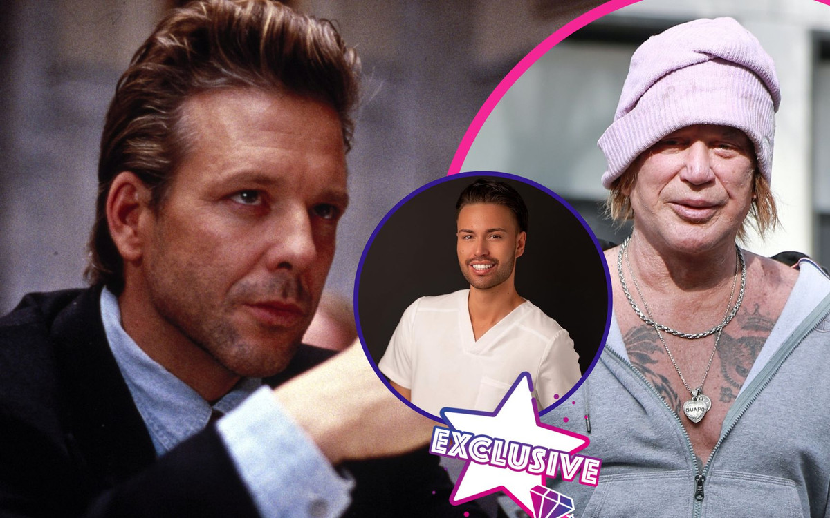 Co poprawiał sobie Mickey Rourke? Specjalista medycyny estetycznej nie poleca łączyć wypełniaczy z….